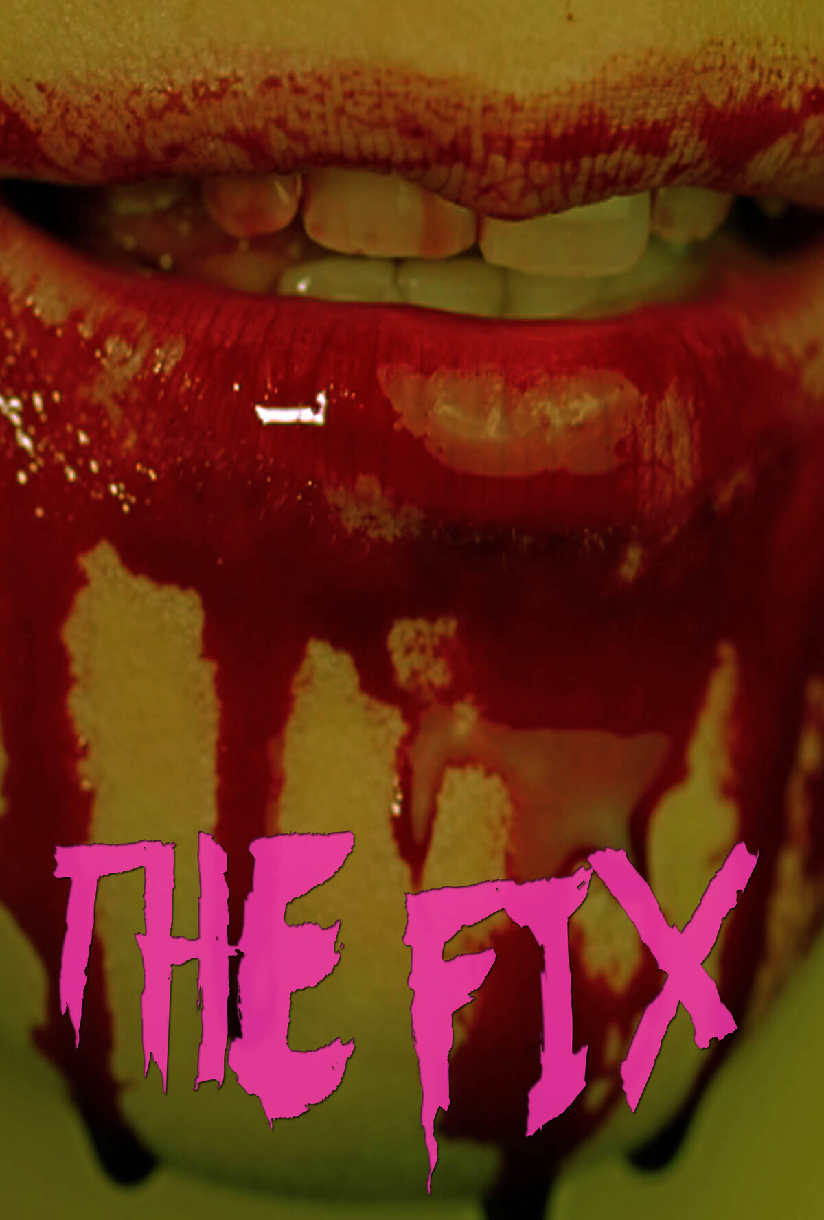 The Fix