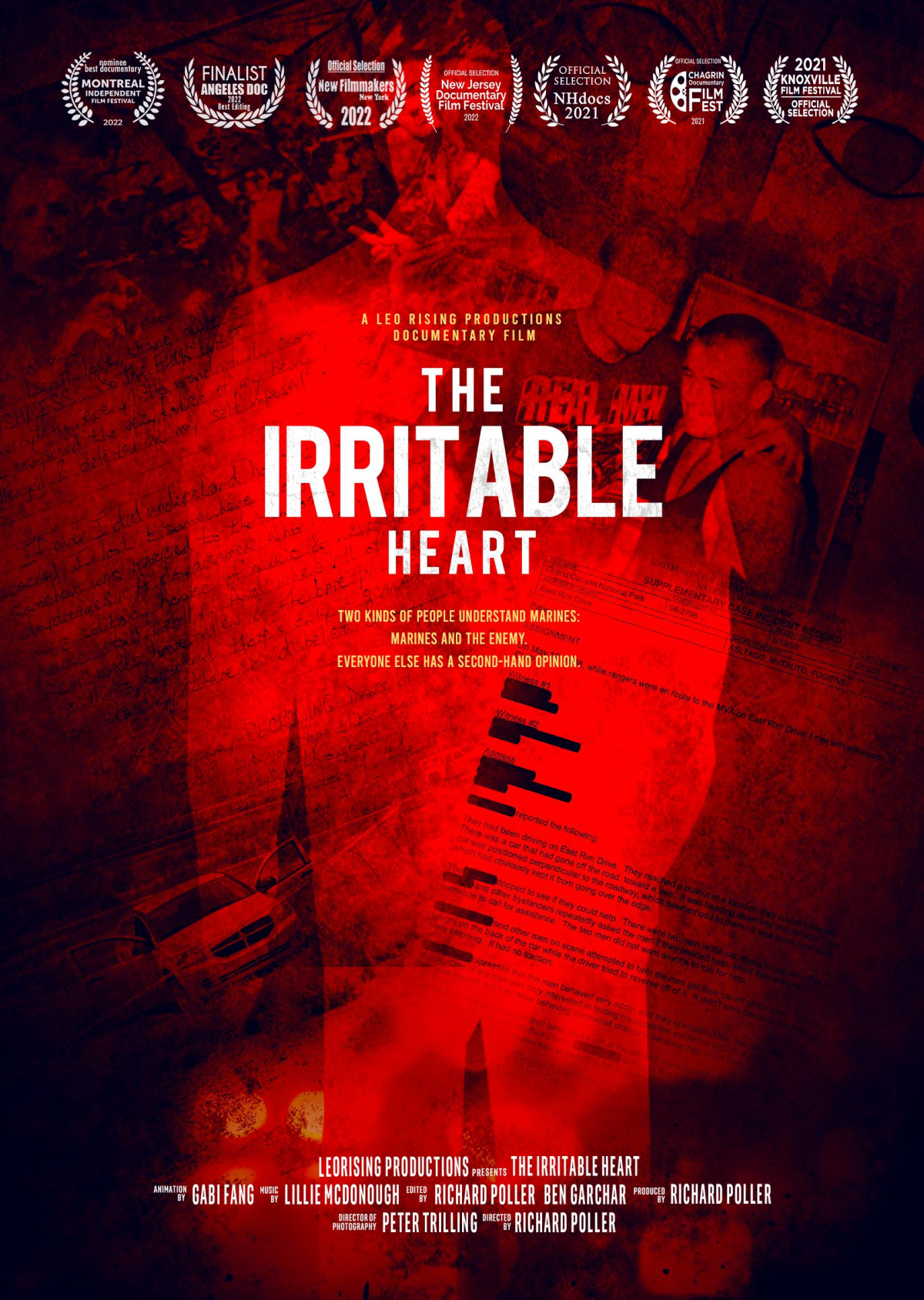 The Irritable Heart