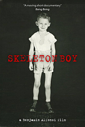 Skeleton Boy