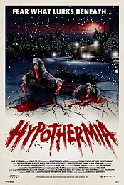 Hypothermia
