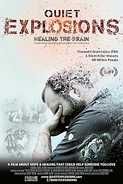 Quiet Explosions: Healing the Brain