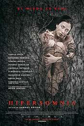 Hypersomnia