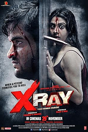 X Ray: The Inner Image