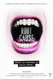 Root Cause