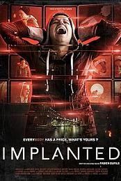 Implanted