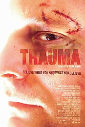 Trauma