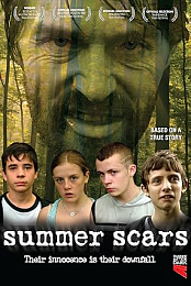 Summer Scars