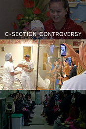 C-Section Controversy