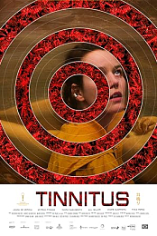 Tinnitus