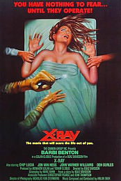 X-Ray