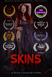 Skins