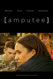 Amputee