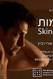 Skin and Bones