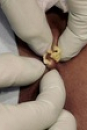 Dr Pimple Popper S08E09 720p WEB h264-BAE EZTV