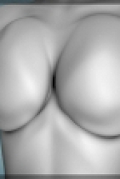 Botched S04E08 720p WEB x264-TBS[eztv]