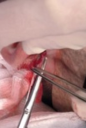 Dr Pimple Popper S07E07 480p x264-mSD EZTV