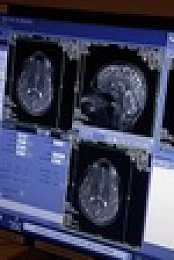Our Brain S01E02 720p HDTV x264-CBFM EZTV