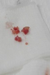 Dr Pimple Popper S07E06 480p x264-mSD EZTV