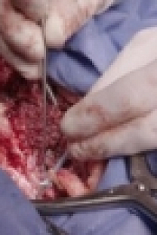 Animal ER S01E01 POed Python 720p WEBRip x264-CAFFEiNE [eztv]