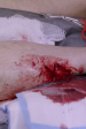 Ambulance Code Red S03E06 1080p HEVC x265-MeGusta EZTV