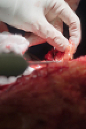 Botched Bariatrics S01E02 1080p WEB h264-FREQUENCY EZTV