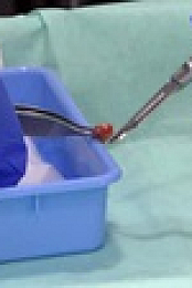 Skin A and E S04E08 XviD-AFG EZTV