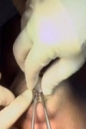 Botched S06E12 480p x264-mSD [eztv]