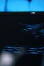 Chicago Med S08E17 XviD-AFG EZTV