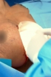 Botched S04E01 720p WEB x264-TBS[eztv]