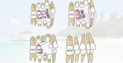 [ FreeCourseWeb ] Udemy - Management of the developing dentition orthodontic cou...