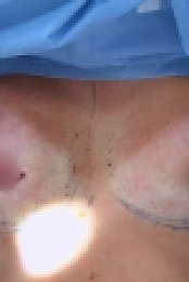 Botched S04E03 720p WEB x264-TBS[eztv]