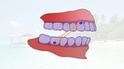 [ FreeCourseWeb ] Udemy - Clear Aligner Orthodontic Treatment