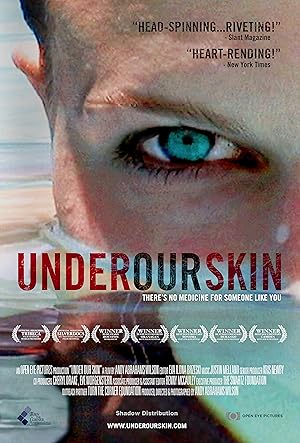 Under Our Skin