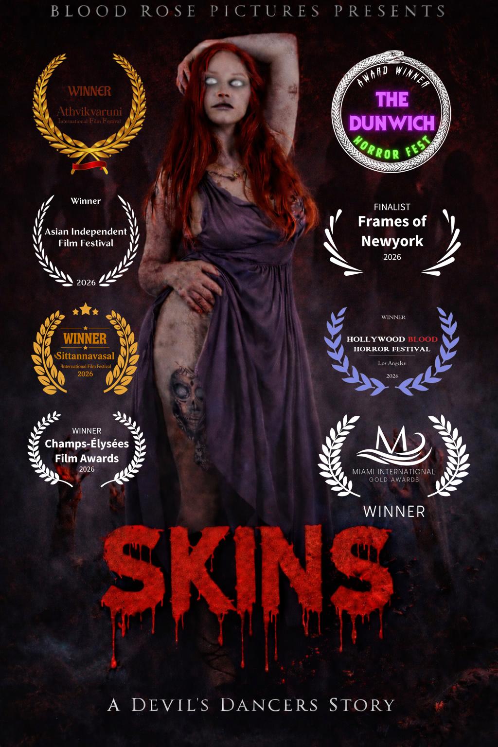 Skins