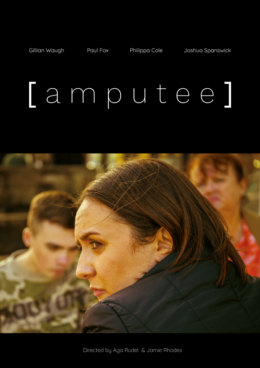 Amputee