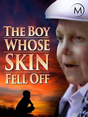 The Boy Whose Skin Fell Off