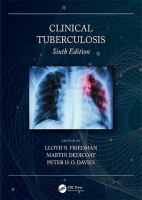 [ FreeCourseWeb ] Clinical Tuberculosis, 6th Edition