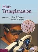[ DevCourseWeb ] Hair Transplantation
