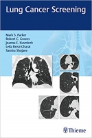 [ FreeCourseWeb ] Lung Cancer Screening, 1st Edition