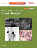[ FreeCourseWeb ] Breast Imaging- Expert Radiology Series