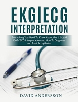 [ FreeCourseWeb ] EKG - ECG Interpretation - Everything you Need to Know about t...