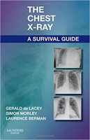 [ FreeCourseWeb ] The Chest X-Ray - A Survival Guide - 1st Edition