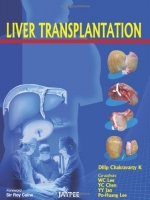 [ FreeCourseWeb ] Liver Transplantation