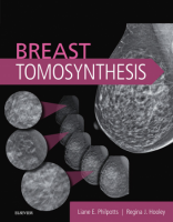 [ FreeCourseWeb ] Breast Tomosynthesis
